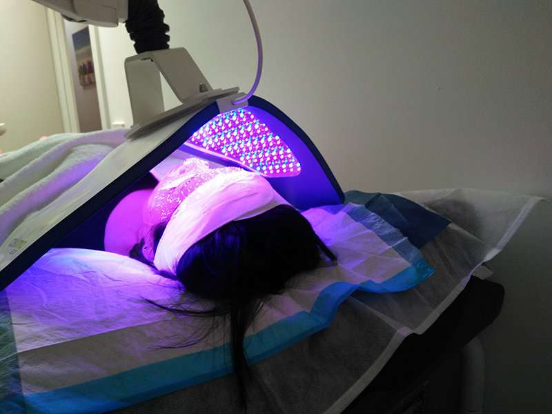 LED light therapy